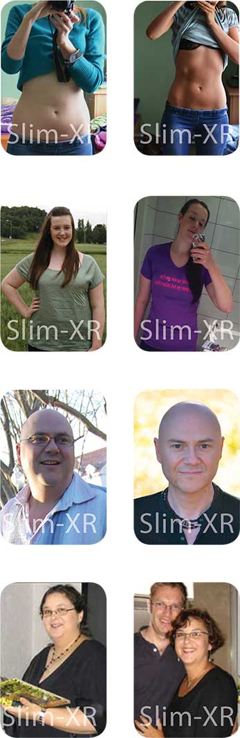 Slim XR